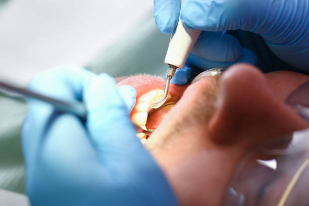 Best Emergency Treatment for Toothache in South River, NJ